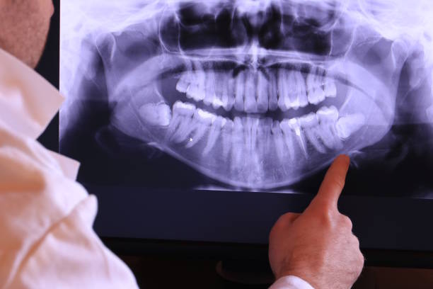 Best Emergency Dental Services for Seniors in Norwood, OK