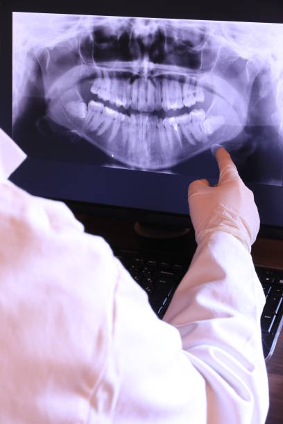Best Emergency Dentist for Knocked-Out Tooth in Norwood, OK